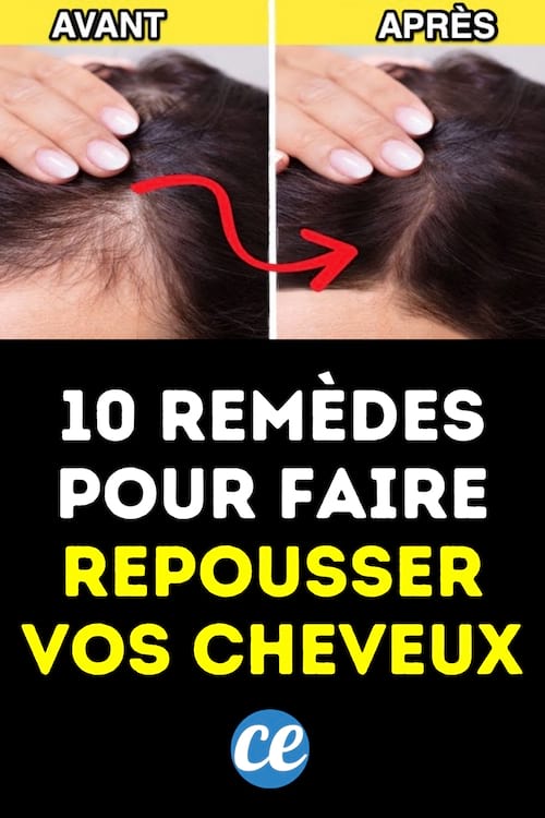 10 Rem&egrave;des Totalement Naturels Pour Faire REPOUSSER Vos Cheveux.