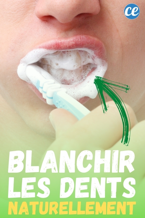 Comment Blanchir Ses Dents Naturellement En Seulement 1 Jour.