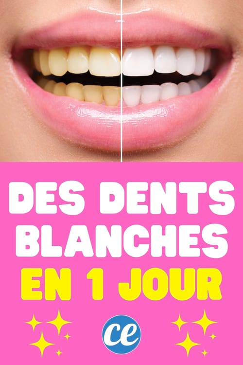 Des dents jaunes avant le traitement et blanches après avec le bicarbonate