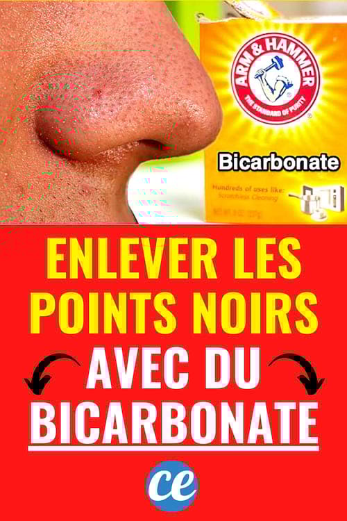 Un nez plein de points noirs et un paquet de bicarbonate de soude pour les retirer