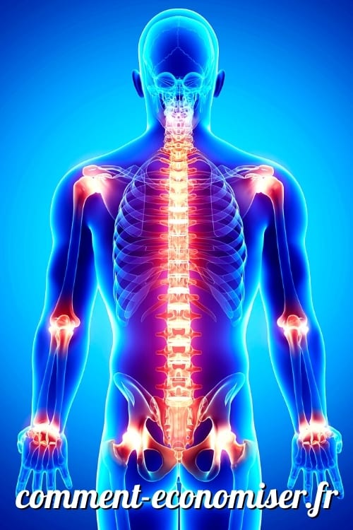 Un squelette bleu qui a des douleurs aux articulations en rouge