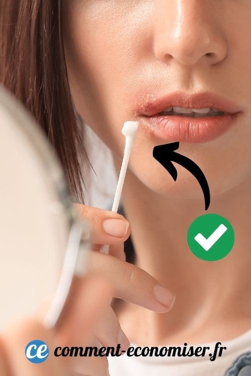 Les crèmes antivirales sont un traitement efficace contre les boutons de fièvre. 