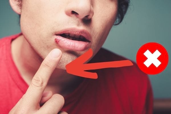 Quels sont les gestes à éviter en cas d'un bouton de fièvre ?