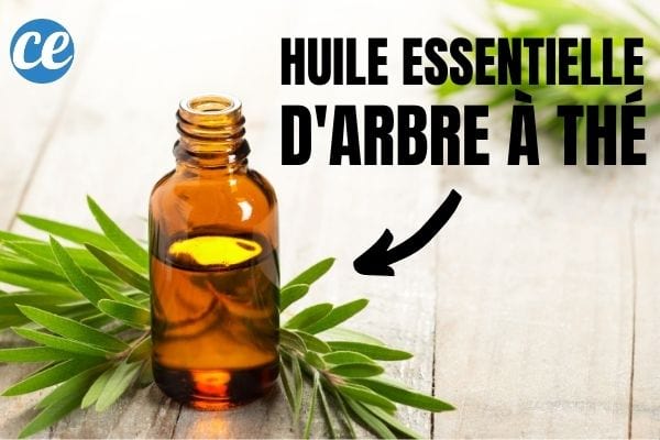 De l'huile d'arbre &agrave; th&eacute; pour soulager les d&eacute;mangeaisons du cuir chevelu.