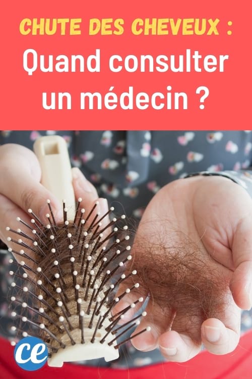 Vos cheveux tombent par poignées ? Quand faut-il consulter un médecin ?