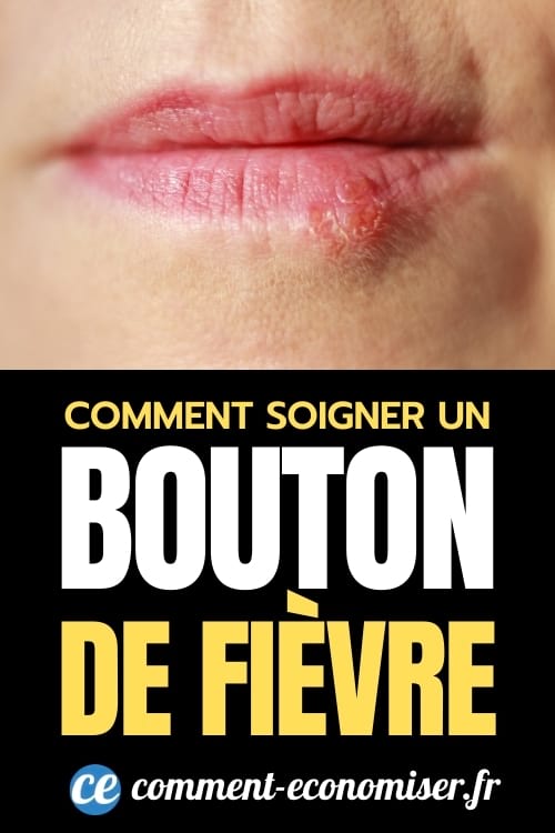 Les meilleurs remèdes de grand-mère pour soigner un bouton de fièvre le plus rapidement possible !