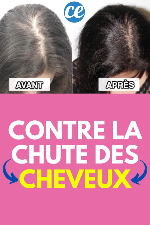 Comment Stopper La Chute Des Cheveux ? 11 Remèdes Naturels.