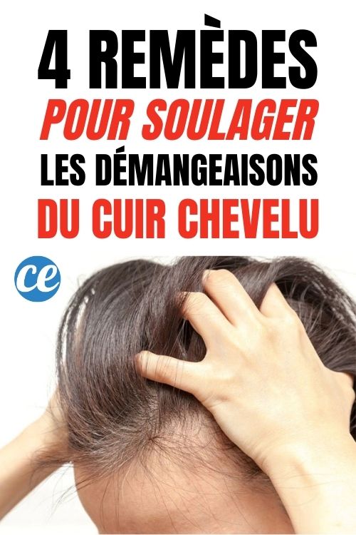 Cuir Chevelu Qui Gratte ? 4 Remèdes Pour Stopper les Démangeaisons.