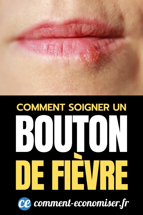 11 Remèdes de Grand-Mère Pour Soigner un Bouton de Fièvre le Plus Vite ...