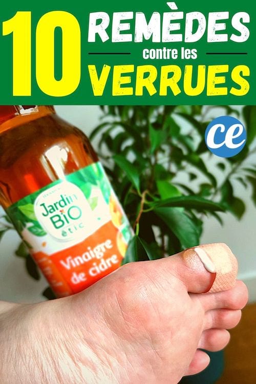 Un pied avec un pansement imbibé de vinaigre de cidre pour faire partir la verrue