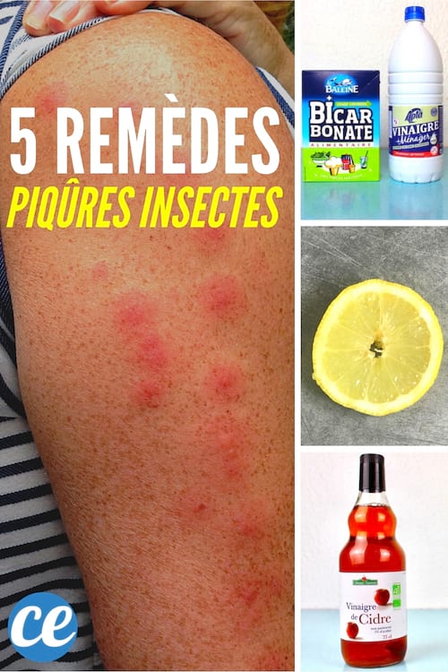 5 Trucs de Grand-Mère Pour Apaiser Piqûre d'Insecte