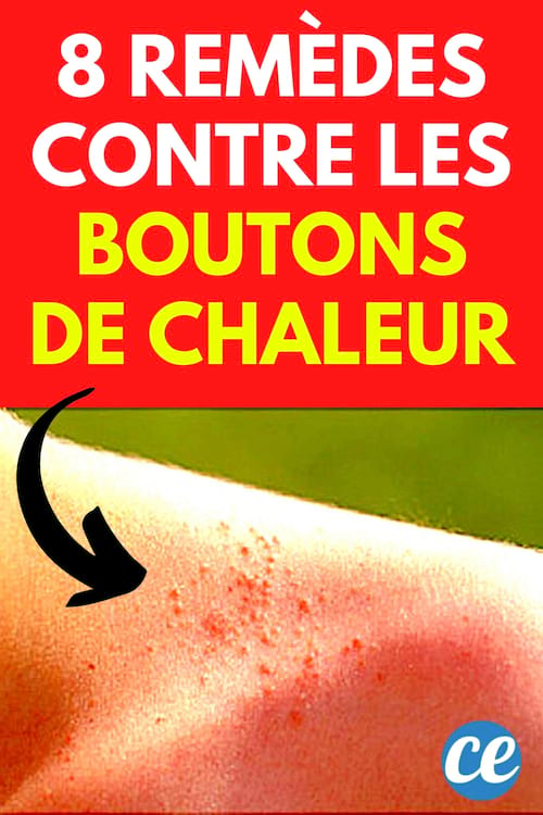 8 Remedes Qui Marchent Pour Se Debarrasser Des Boutons De Chaleur