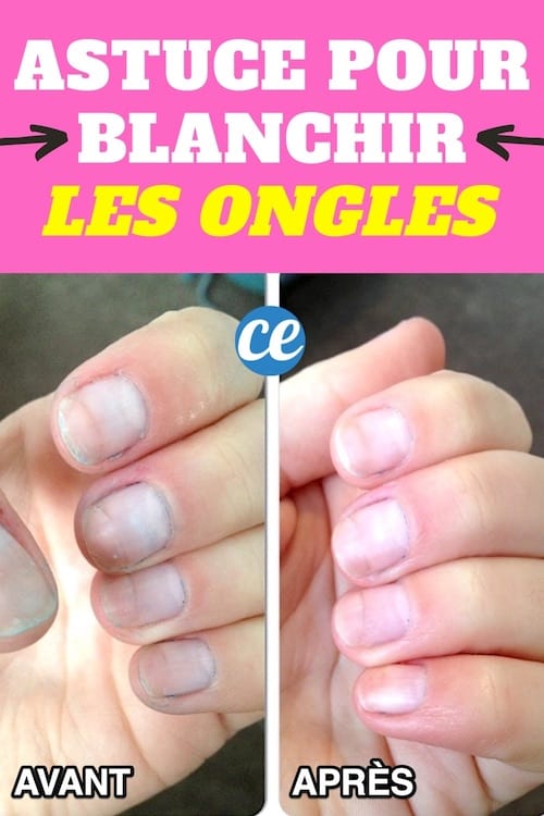 Des ongles jaunis avant et tout blanc après grâce au bicarbonate