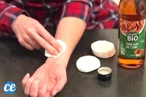 Vinaigre de cidre pour se débarrasser des boutons de chaleur 