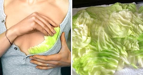 Des feuilles de chou pour apaiser les mamelons irrités par l'allaitement
