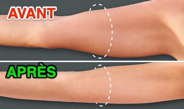 Des bras qui sont gros avant et après mince grâce aux exercices