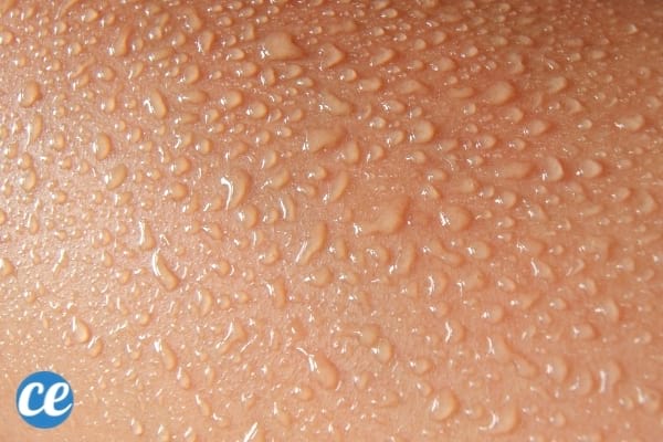 Zone de peau avec beaucoup de transpiration 