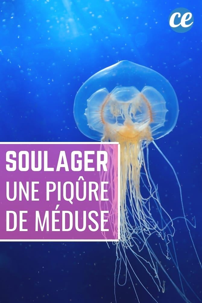 soigner les piqures de m&eacute;duse comment faire