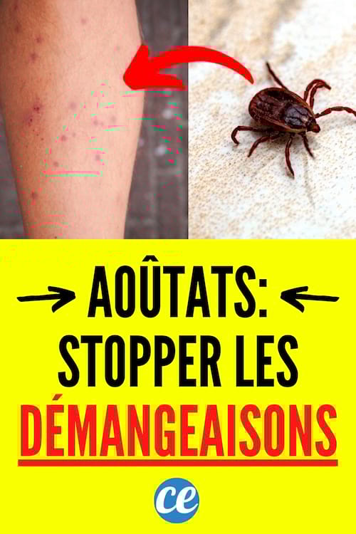 remède naturels pour arrêter démangeaison bouton aoutat