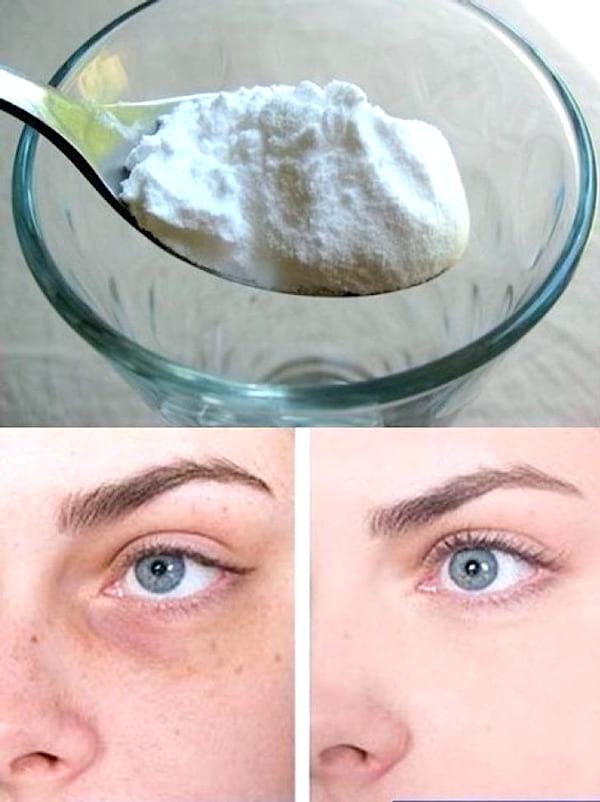 Utilisez du bicarbonate sous les yeux contre les cernes