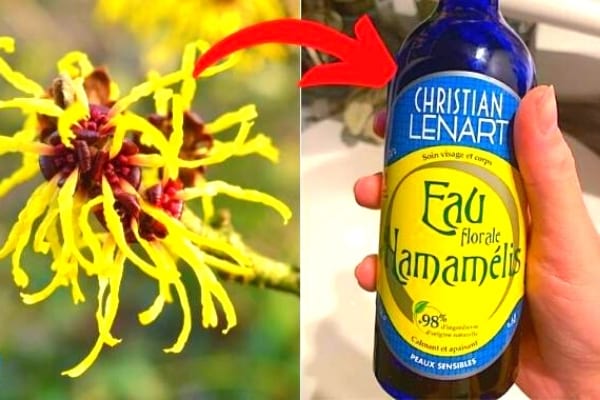 L'hamamélis est un remède naturel et efficace contre le psoriasis du cuir chevelu.