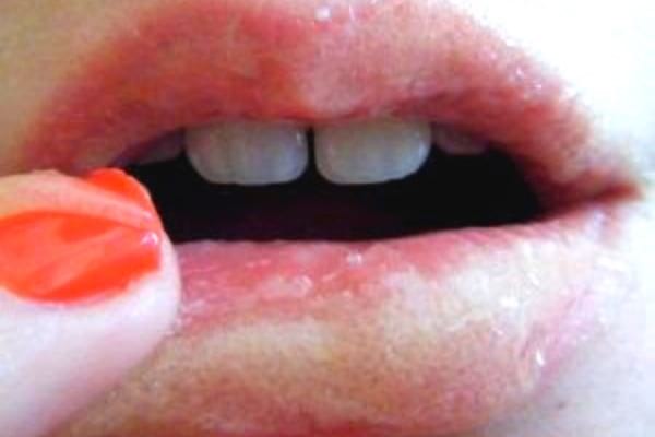 gommage maison sur lèvres