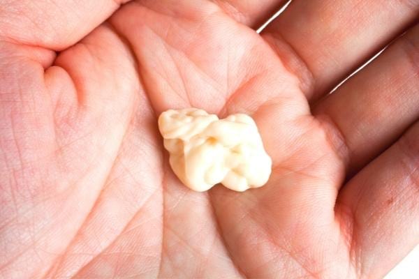 Un chewing-gum enlevé des cheveux grâce à l'huile d'olive dans une paume de main