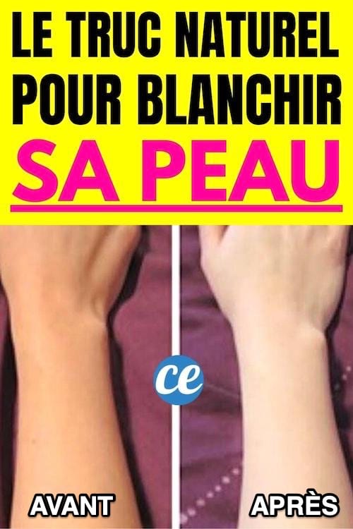 Une main avec une peau foncé avant le soin et après blanche grâce au citron