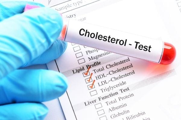 un test sanguin pour le cholestérol