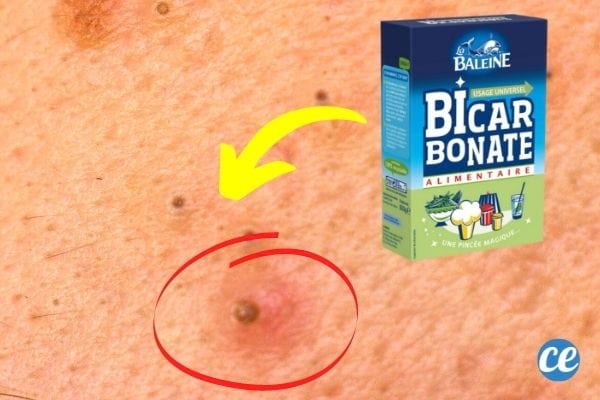 pont noir et boite de bicarbonate