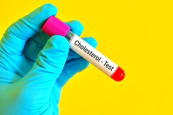 Un test permettant de connaitre son taux de cholestérol