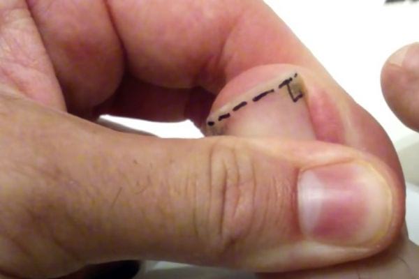 un angle droit formé sur l'ongle pour le couper