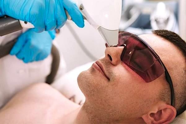 Une épilation au laser pour enlever les poins du nez