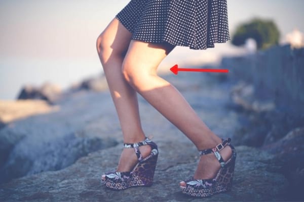 genou fléchi à cause de talons hauts
