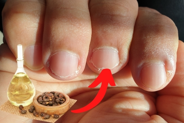 Comment Utiliser Lhuile De Ricin Pour Les Ongles Et Les Faire Pousser