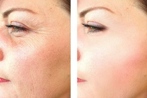 Un visage avec des rides et un visage sans ride grâce à l'huile d'amande douce