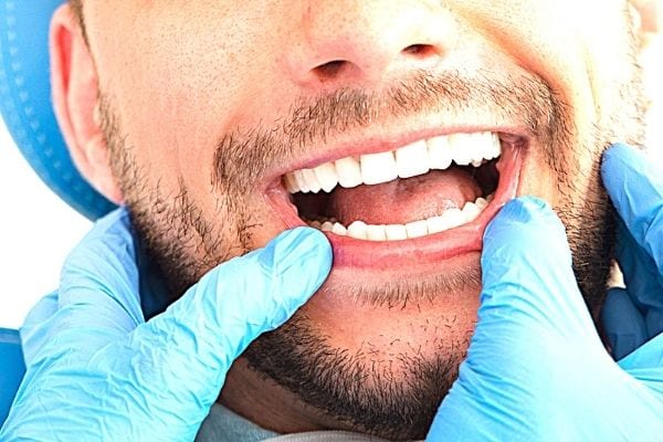 un homme avec les dents blanches se fait examiner la bouche chez le dentiste