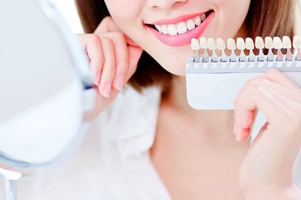 une femme avec les dents blanches et un nuancier pour les dents