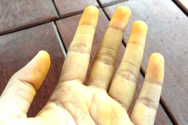 comment enlever tache de curcuma sur les doigts