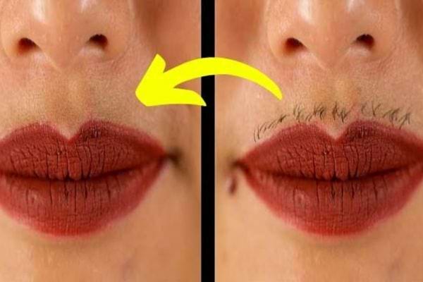 Décolorez-vous les poils du visage avec des remèdes naturels