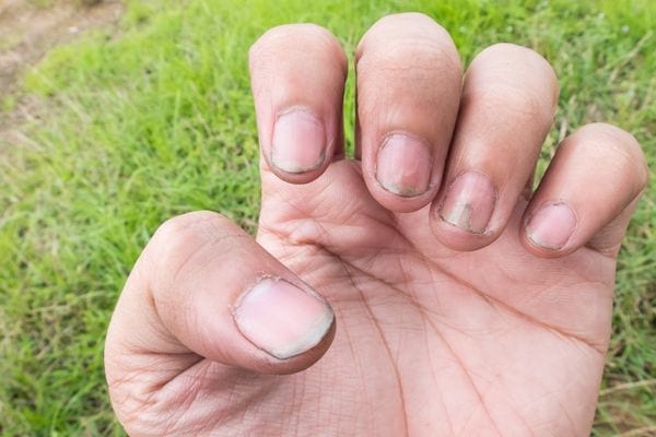 Un main d'homme avec des ongles sales
