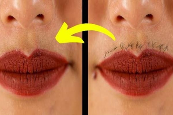 Poils au Menton : Pourquoi les Femmes En Ont ? Et Comment S'en Débarrasser.