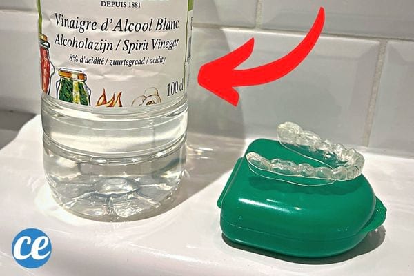 Vinaigre blanc pour nettoyer des gouttières dentaire 