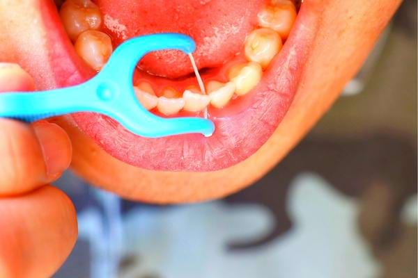 Un nettoyage entre les dents avec du fil dentaire