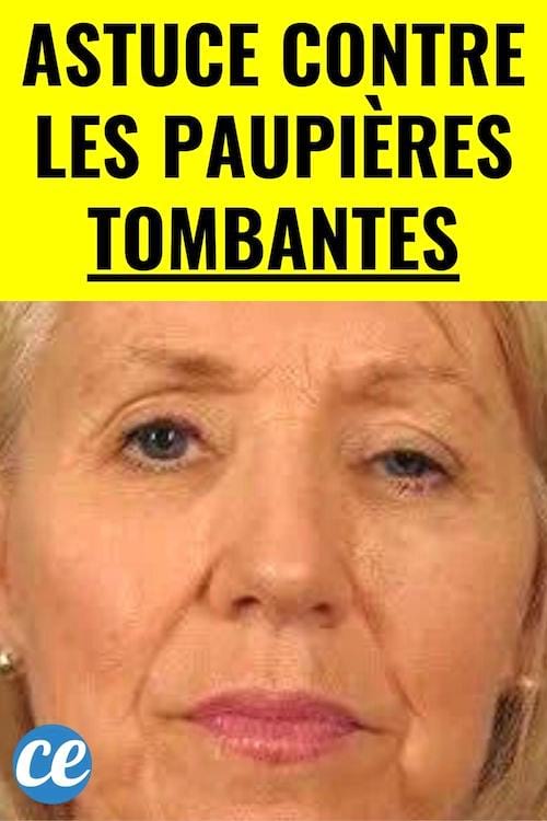 Une femme qui a une paupière tombante sur un oeil et qui va utiliser un remède