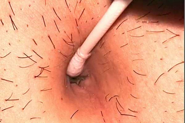 Un coton-tige dans un nombril pour le nettoyer 