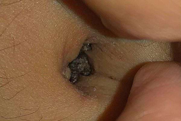 Un nombril avec de la saleté à l'intérieur 