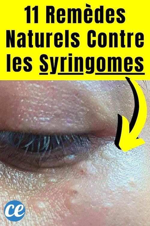 Des syringomes sous un oeil avec des petits boutons que l'on peut traiter au naturel