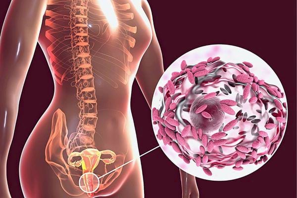 Des bactéries dans le système reproductif de la femme 