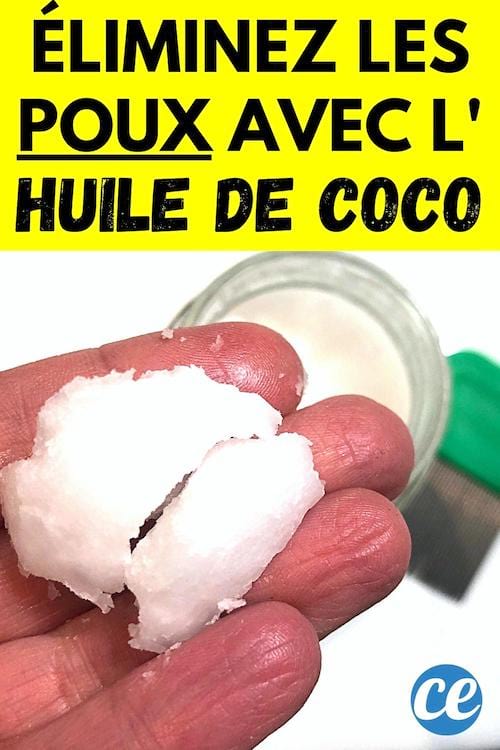 De l'huile de coco pour éliminer les poux sur les cheveux